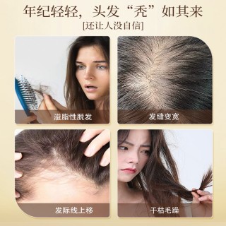 菲小主 经典养发洗发水500mI【养发防断】
