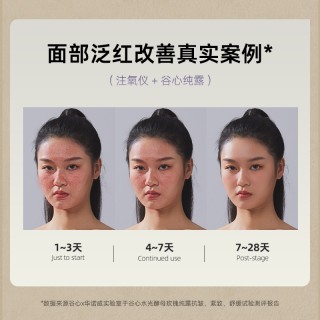 【直降100元，下单赠谷心纯露30ml】二代升级款注氧仪 谷心注氧仪P01S升级款手持喷雾